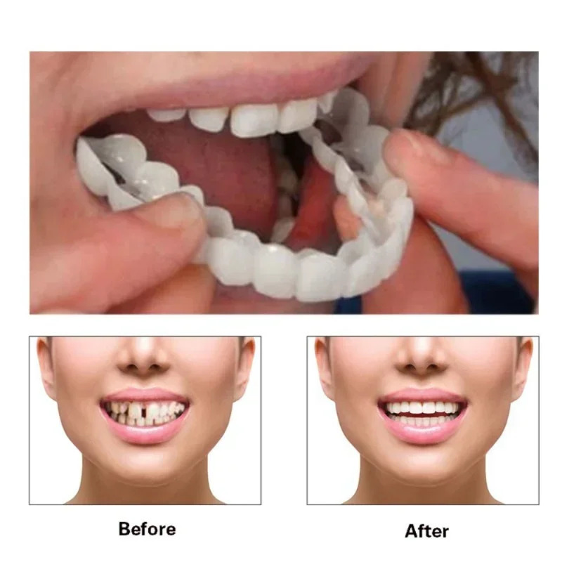 Quick Makeup Teeth Veneers, In - Beauty Makeup Look avis et prix